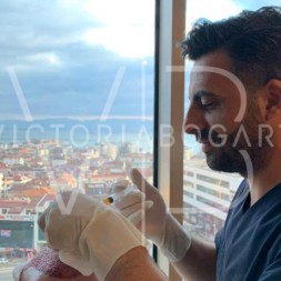 Which hair transplant technique is best?